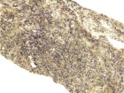 Zoom image: Cell stain