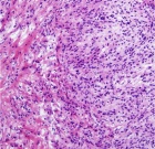 Zoom image: Cell stain