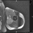 Zoom image: Radiological image