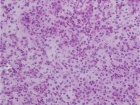 Zoom image: Cell stain