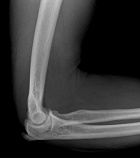 Zoom image: Radiological image