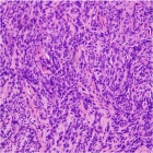 Zoom image: Cell stain