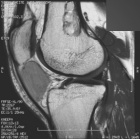 Zoom image: Radiological image