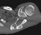 Zoom image: Radiological image