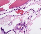Zoom image: Cell stain