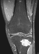 Zoom image: Radiological image
