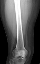 Zoom image: Radiological image