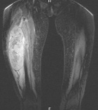 Zoom image: Radiological image