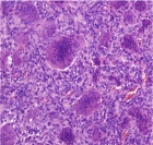 Zoom image: Cell stain