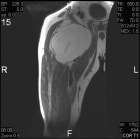 Zoom image: Radiological image