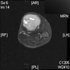 Zoom image: Radiological image