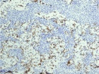 Zoom image: Cell stain