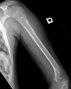 Zoom image: Radiological image