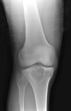 Zoom image: Radiological image