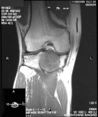 Zoom image: Radiological image