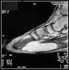 Zoom image: Radiological image
