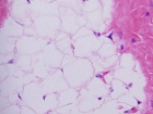 Zoom image: Cell stain