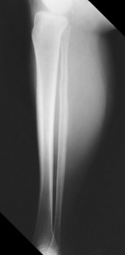 Zoom image: Radiological image