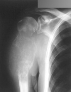 Zoom image: Radiological image