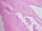 Zoom image: Cell stain
