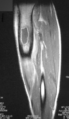 Zoom image: Radiological image