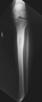 Zoom image: Radiological image