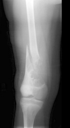 Zoom image: Radiological image