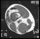 Zoom image: Radiological image