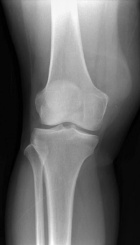 Zoom image: Radiological image