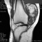 Zoom image: Radiological image