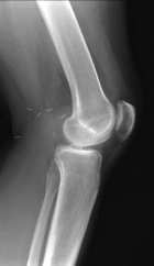 Zoom image: Radiological image