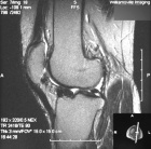 Zoom image: Radiological image