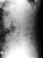 Zoom image: Radiological image