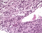 Zoom image: Cell stain