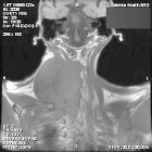 Zoom image: Radiological image