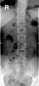 Zoom image: Radiological image