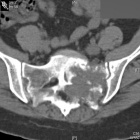 Zoom image: Radiological image