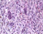 Zoom image: Cell stain