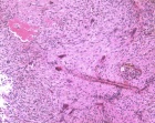 Zoom image: Cell stain