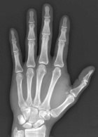 Zoom image: Radiological image