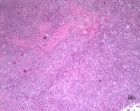 Zoom image: Cell stain