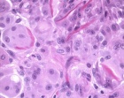 Zoom image: Cell stain