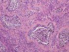 Zoom image: Cell stain