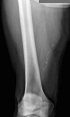 Zoom image: Radiological image