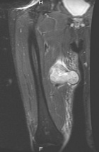 Zoom image: Radiological image