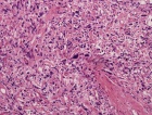 Zoom image: Cell stain