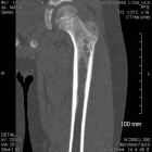 Zoom image: Radiological image