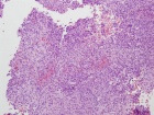 Zoom image: Cell stain