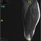 Zoom image: Radiological image