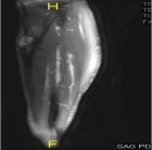 Zoom image: Radiological image